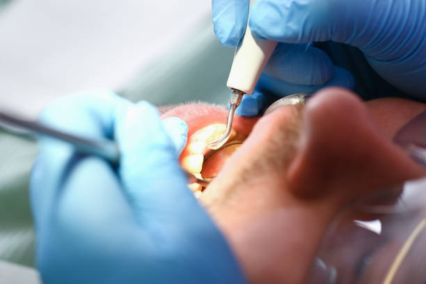 Best Emergency Tooth Extraction  in Galena, OH